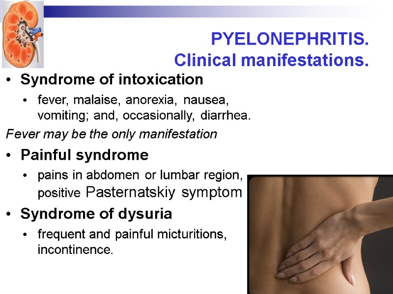 PYELONEPHRITIS.  Clinical manifestations. Syndrome of intoxication  fever, malaise, anorexia, nausea, vomiting; and,